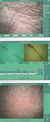 Examens et analyses capillaires -  - ESTHETICAP - Centre d'Expertise Capillaire
